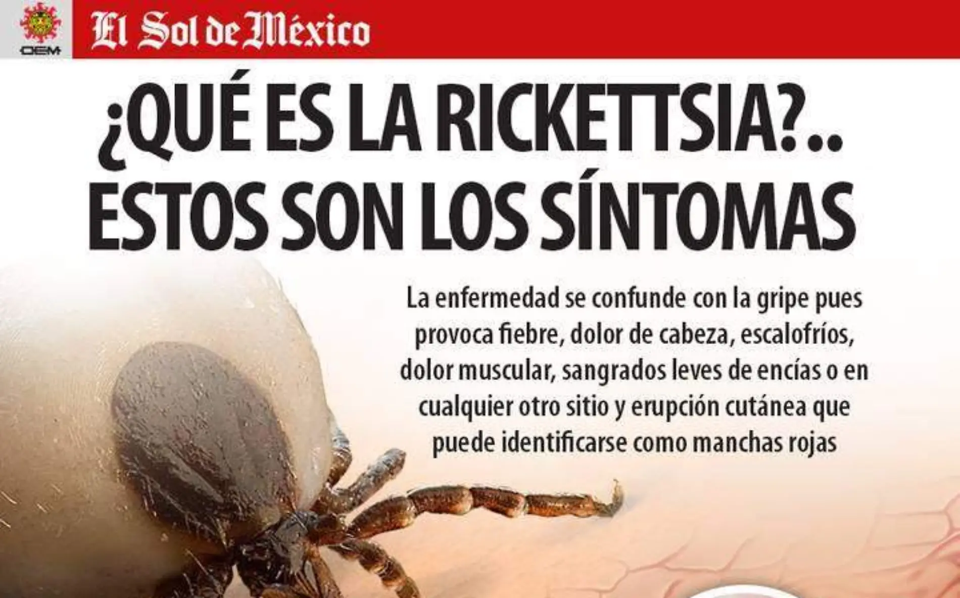 Infografía Rickettsia